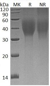 Human CD320/8D6A/UNQ198/PRO224 (His tag) recombinant protein