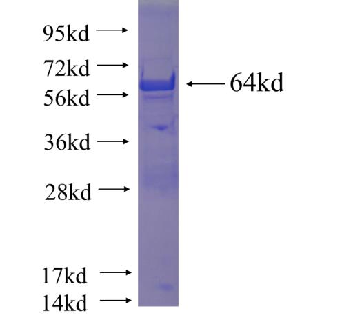 Recombinant human CCDC155 SDS-PAGE