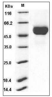 Influenza A H11N9 (A/mallard/Alberta/294/1977) Hemagglutinin Protein (HA1 Subunit) (His Tag) SDS-PAGE