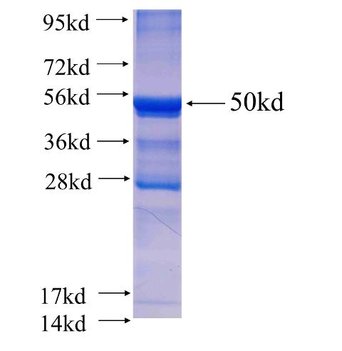 Recombinant human THOC7(Full length) SDS-PAGE