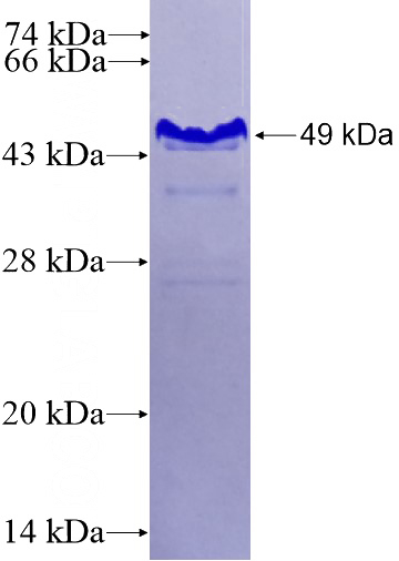 Recombinant Human DLL4 SDS-PAGE
