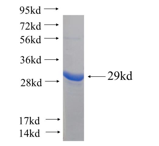 Recombinant human STEAP3 SDS-PAGE