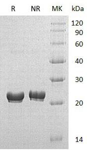 Human RPS7 (His tag) recombinant protein
