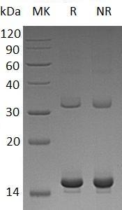 Human HBZ/HBZ2 (His tag) recombinant protein