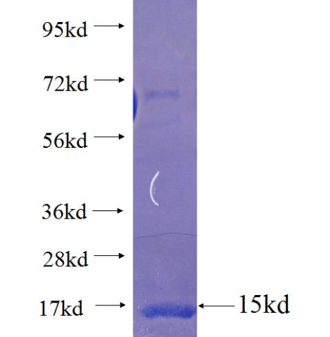 Recombinant human SCLT1 SDS-PAGE