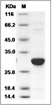 Human UBASH3B / Sts1 / TULA-2 Protein (His Tag) SDS-PAGE