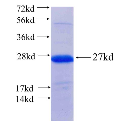 Recombinant human WDR22 SDS-PAGE