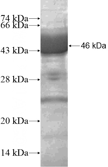 Recombinant Human GUCY1A2 SDS-PAGE