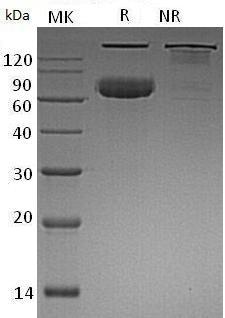 Human CD320/8D6A/UNQ198/PRO224 (Fc tag) recombinant protein
