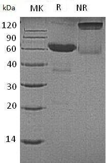 Human CD7 (Fc tag) recombinant protein