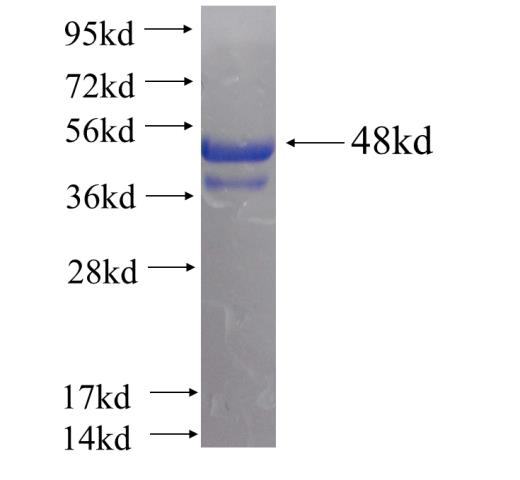 Recombinant human CHMP1A(Full length) SDS-PAGE