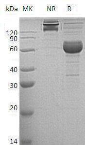 Human NCR1/LY94 (Fc tag) recombinant protein