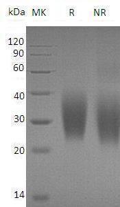 Human PTH1R (His tag) recombinant protein