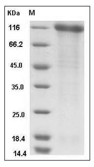 Human SELP / selectin P / P-selectin Protein (His Tag) SDS-PAGE
