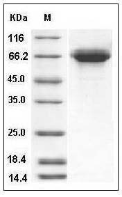 Influenza A H13N8 (A/black-headed gull/Netherlands/1/00) Hemagglutinin / HA Protein (His Tag) SDS-PAGE