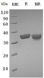 Mouse Gzmb/Ctla-1/Ctla1 (His tag) recombinant protein