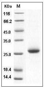 Human NBL1 / DAND1 / DAN Protein (His Tag) SDS-PAGE