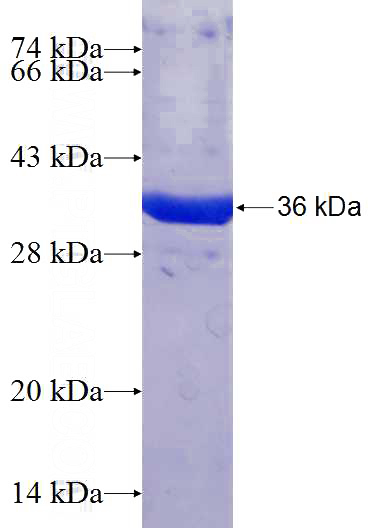 Recombinant Human NME7 SDS-PAGE
