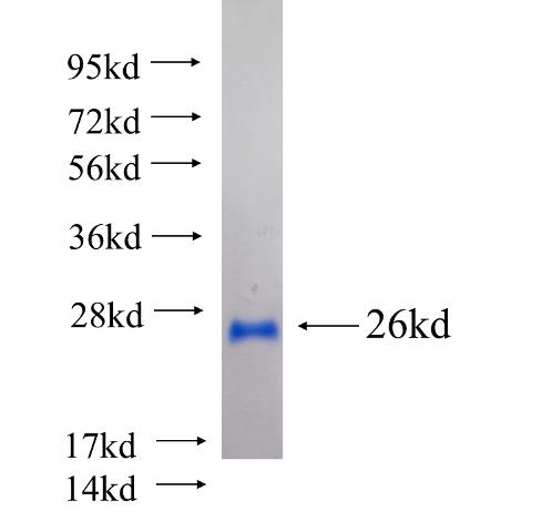 Recombinant human TNFAIP8L2 SDS-PAGE