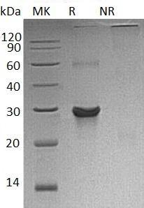 Human ATG10/APG10L/PP12616 (His tag) recombinant protein