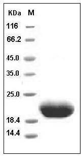 Human IL6 / Interleukin-6 Protein SDS-PAGE