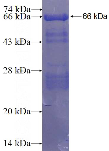 Recombinant Human AFF4 SDS-PAGE