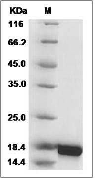 Human IL10 / Interleukin-10 Protein SDS-PAGE