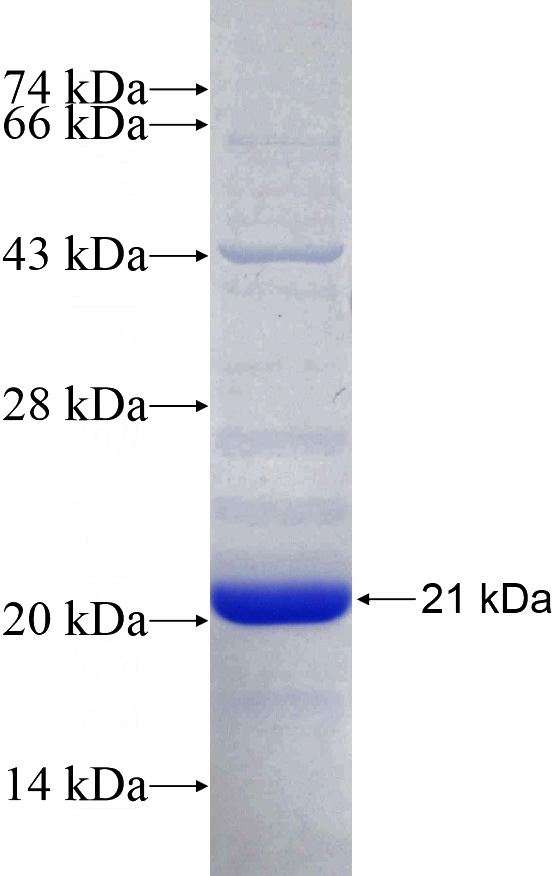 Recombinant Human BSEP SDS-PAGE