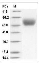 Mouse PLAUR/CD87 (His Tag) recombinant protein