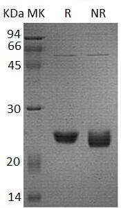 Human UBE2M/UBC12 recombinant protein