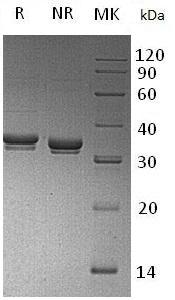 Mouse Extl2/Extr2 (His tag) recombinant protein