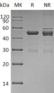 Human UBE2H (GST tag) recombinant protein