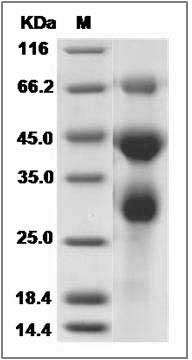 Influenza A H7N9 (A/Shanghai/1/2013) Hemagglutinin / HA Protein (HA1+HA2, cleavage) (His Tag) SDS-PAGE