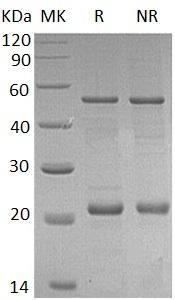 Human BAX/BCL2L4 (His tag) recombinant protein
