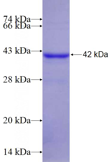 Recombinant Human AR SDS-PAGE