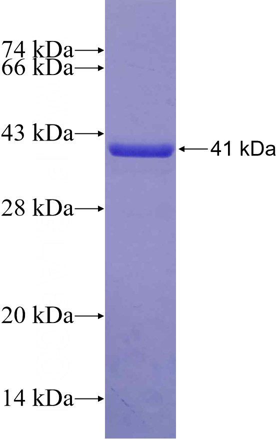 Recombinant Human LIG3 SDS-PAGE