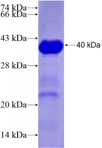Recombinant Human CNOT2 SDS-PAGE