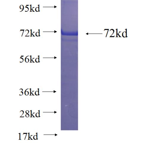 Recombinant human P62;SQSTM1(Full length) SDS-PAGE