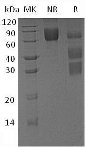 Mouse Clu/Apoj/Msgp-2 (His tag) recombinant protein