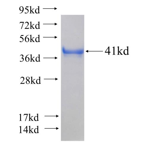 Recombinant human CPNE5 SDS-PAGE
