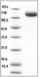 Human MICB Protein (His & Fc Tag) SDS-PAGE