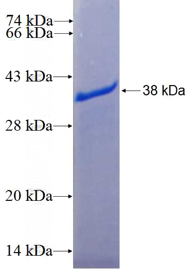 Recombinant Human CCDC114 SDS-PAGE