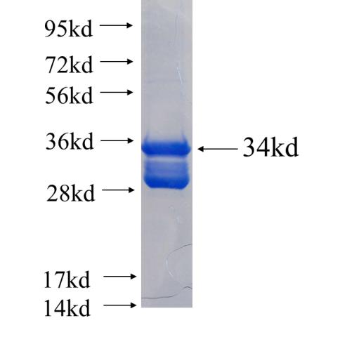 Recombinant human ATP2A1 SDS-PAGE