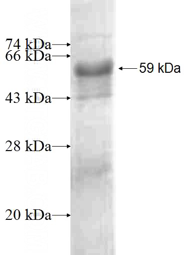 Recombinant Human PPP2R2C SDS-PAGE
