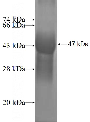 Recombinant Human CSRP2 SDS-PAGE