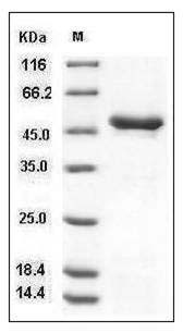 Human Tryptophan Hydroxylase 1 / TPH1 Protein (His Tag) SDS-PAGE