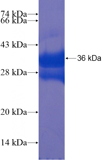 Recombinant Human TLX1 SDS-PAGE