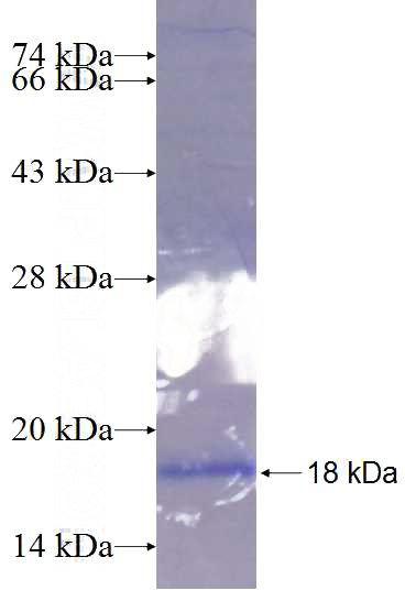 Recombinant Human SPAG11A SDS-PAGE