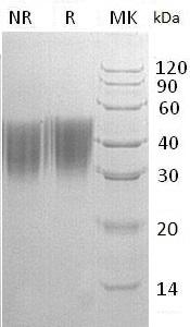 Human ORM2/AGP2 (His tag) recombinant protein