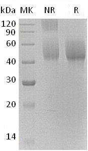 Human LYVE1/CRSBP1/HAR/XLKD1 (His tag) recombinant protein